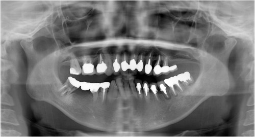 杉山１　初診時　◎